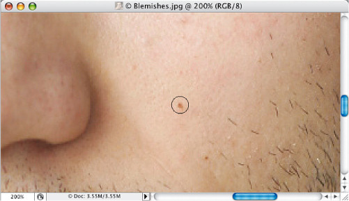 Faces. Retusz zdj�� portretowych - Usuwanie przebarwie� na sk�rze