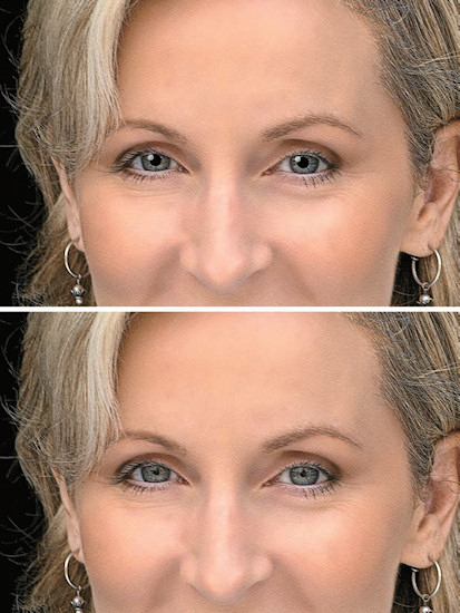 O�wietlenie w fotografii portretowej - Proste o�wietlenie portretowe