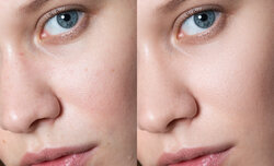 Retouch4me – automatyczna obr�bka zdj�� przez sztuczn� inteligencj�